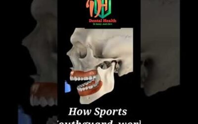 How mouth guard works