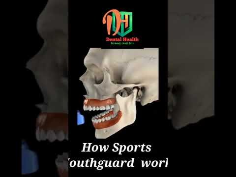 How mouth guard works